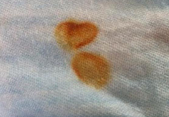 怎么除锈渍,白衣服锈迹用什么能洗掉图5