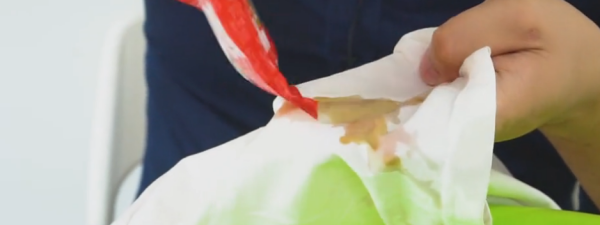 裤子上有树胶怎么洗掉,裤子沾到树胶怎么洗掉图4