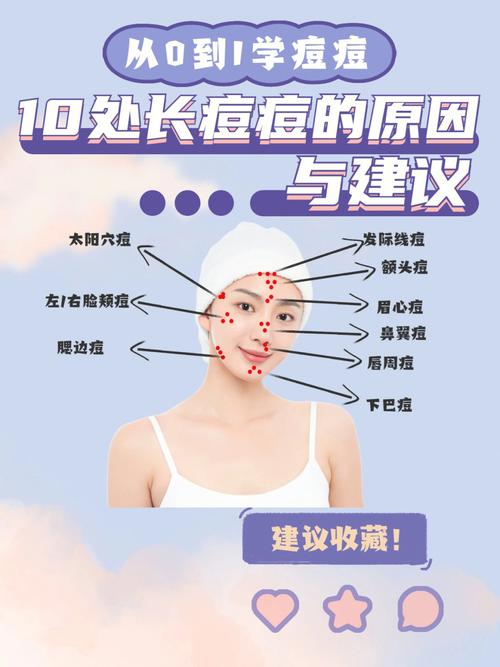 脸上长痘痘的原因（五大原因需知道）