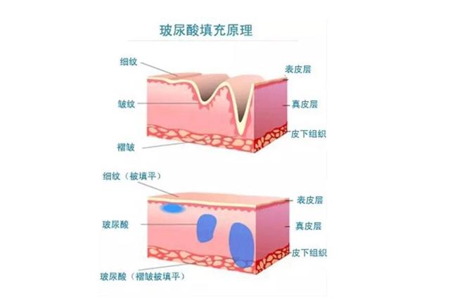 这些你使用过的玻尿酸（连明星都喜爱的玻尿酸）(7)