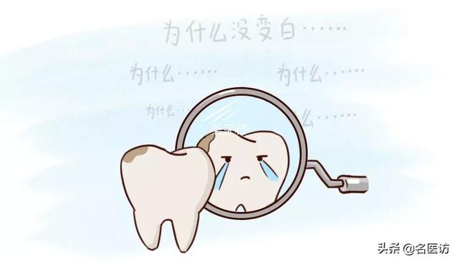 牙齿美白最好的方法和步骤（看完这八种美白方式就懂了）(7)
