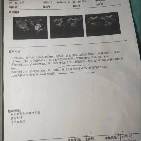 高中就有多囊卵巢该怎么办?找金哲堂高金哲主任才看好